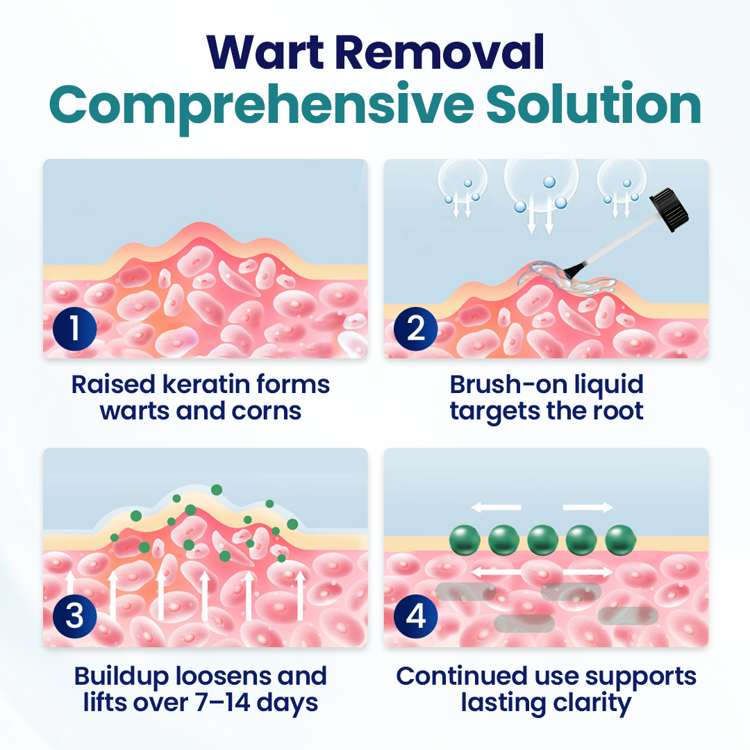 DermChiller® Clinically-Inspired Wart & Corn Removal — Precision Renewal You Can Trust🎁