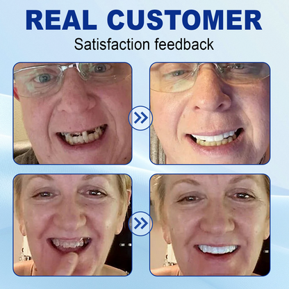 [Official Brand Store] Seurico™ Advanced Customized Full Denture Set - ⏰🔥Limited Time Only: Get 50% Off Now!