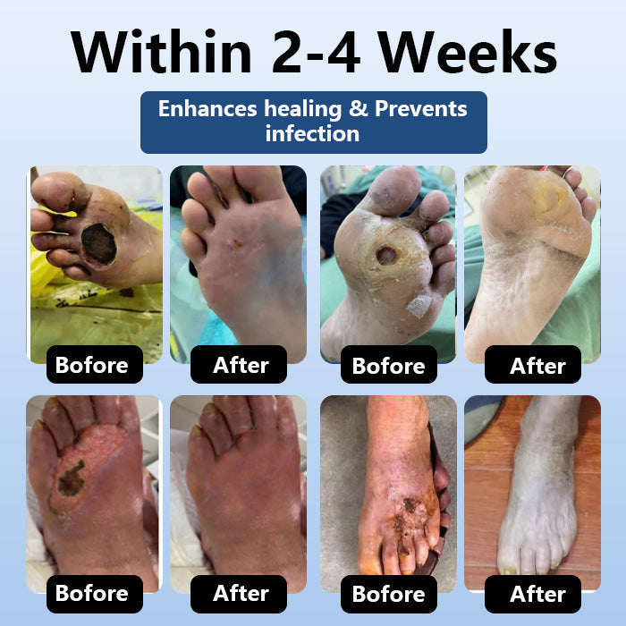 DiabeHeal™ Diabetic Skin Healing Cream 🌿