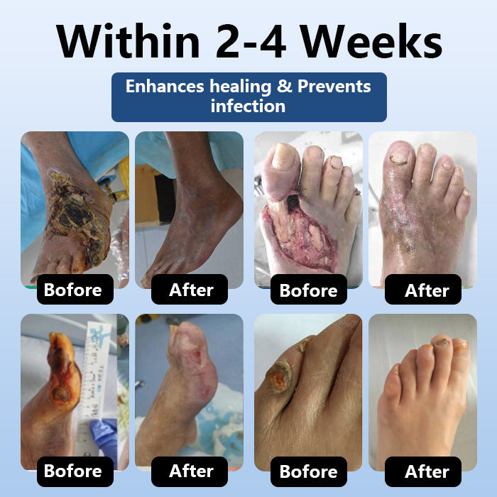 DiabeHeal™ Diabetic Skin Healing Cream 🌿