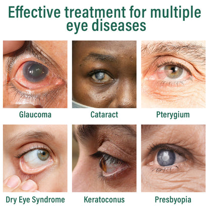 👩‍⚕️Ourlyard® Nano Eye Drops Serum ✅FDA Approved(Suitable for presbyopia, dry eye syndrome, glaucoma, and cataracts) ☘️☘️