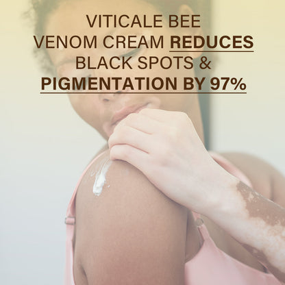 DermaVeenix® VitiClear Bee Venom Cream Ultra💧