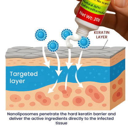 Gynovia®: Wart-Free in 14 Days. Made for Women.Confidential Delivery