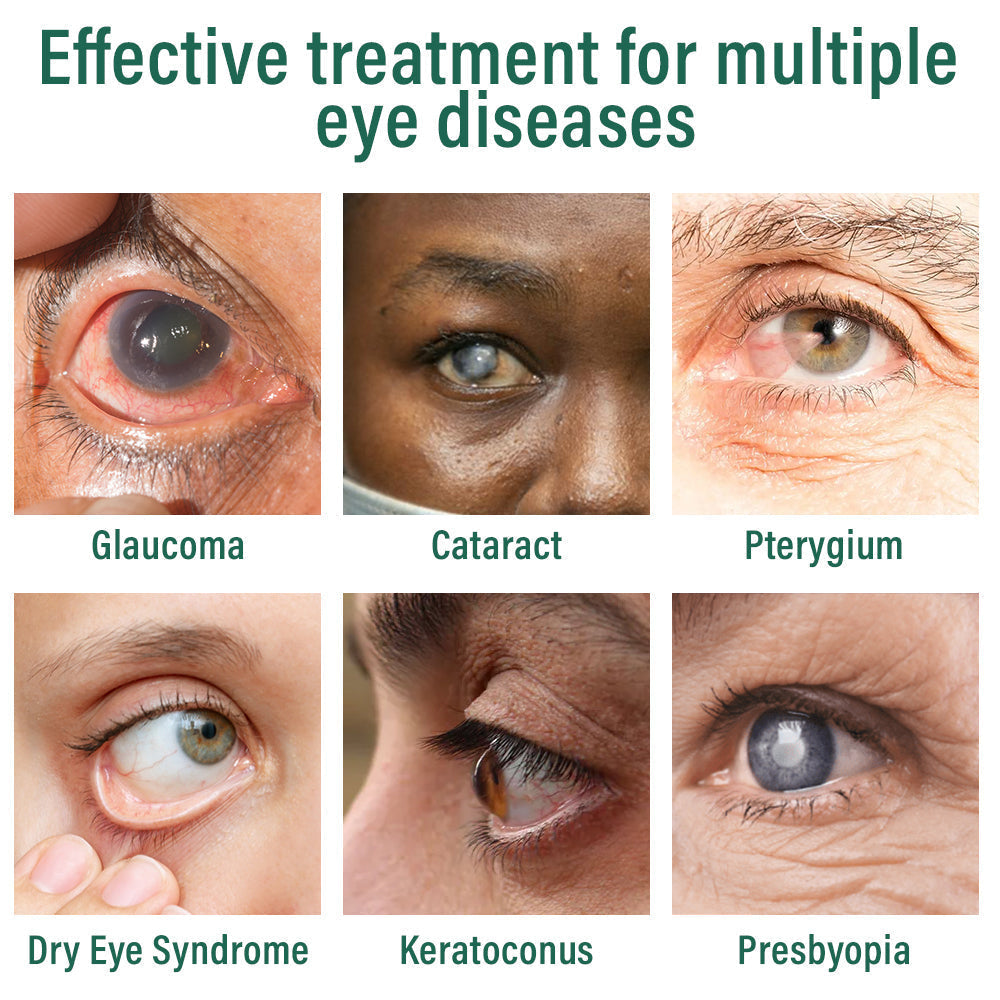 Lucenzy® Nano Eye Drops Serum 👩⚕️