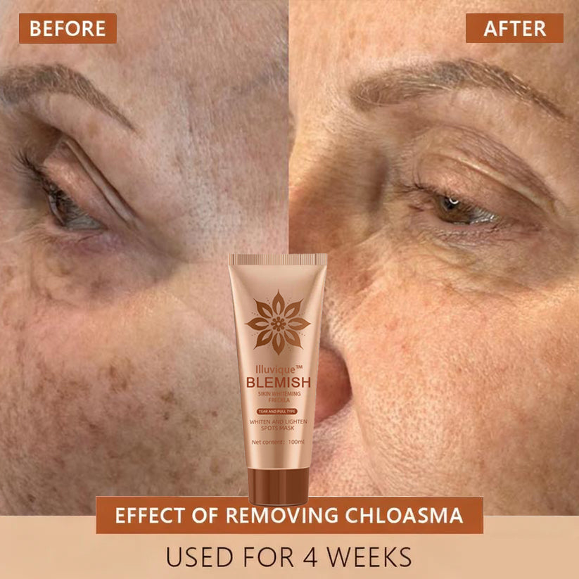 Reveal Your Timeless Radiance — Illuvique™ Delivers Spotless, Luminous Skin from Face to Body🌿