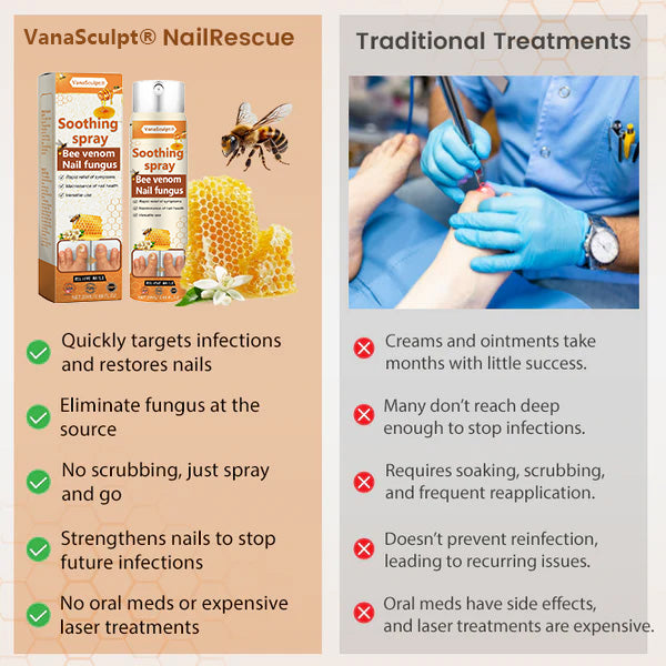 VanaSculpt® Bienenvergiftung Nagelpilz Spray