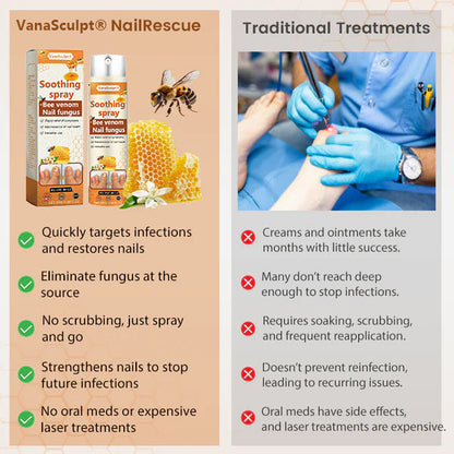 VanaSculpt® Bienenvergiftung Nagelpilz Spray