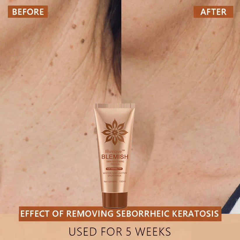 Reveal Your Timeless Radiance — Illuvique™ Delivers Spotless, Luminous Skin from Face to Body🌿