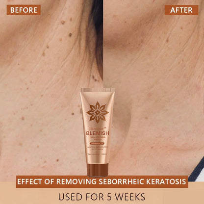 Reveal Your Timeless Radiance — Illuvique™ Delivers Spotless, Luminous Skin from Face to Body🌿