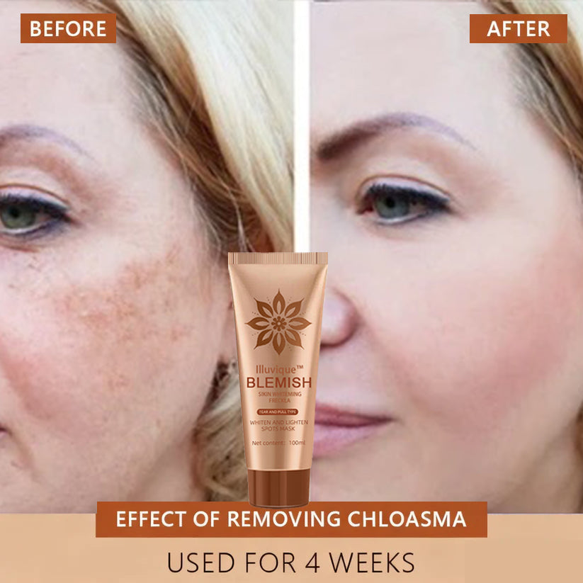 Reveal Your Timeless Radiance — Illuvique™ Delivers Spotless, Luminous Skin from Face to Body🌿