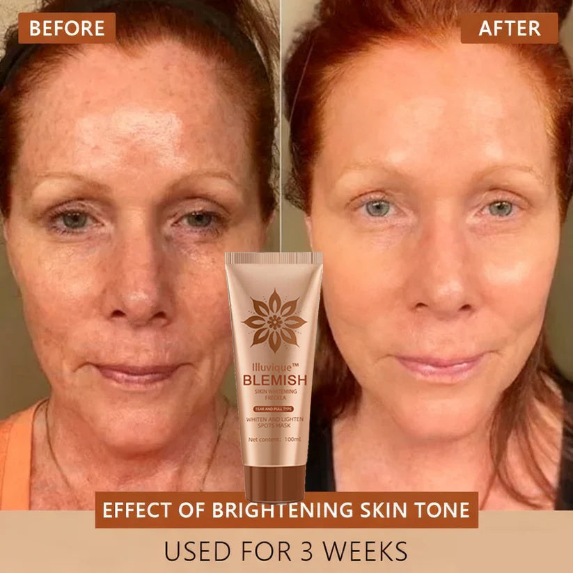 Reveal Your Timeless Radiance — Illuvique™ Delivers Spotless, Luminous Skin from Face to Body🌿