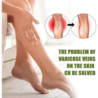 🔥Varellix™ Sale Varicose Veins Relief Spray – Herbal Treatment For Spider & Varicose Veins - 94% Of Users See Visible Results Within 1 To 2 Weeks!🔥