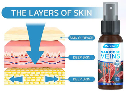 🔥Varellix™ Sale Varicose Veins Relief Spray – Herbal Treatment For Spider & Varicose Veins - 94% Of Users See Visible Results Within 1 To 2 Weeks!🔥