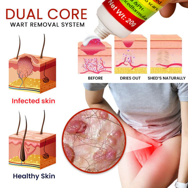 Gynovia®: Wart-Free in 14 Days. Made for Women.Confidential Delivery