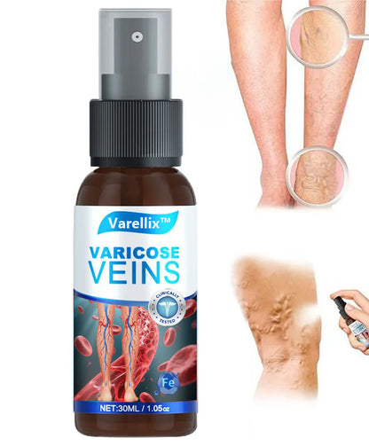 🔥Varellix™ Sale Varicose Veins Relief Spray – Herbal Treatment For Spider & Varicose Veins - 94% Of Users See Visible Results Within 1 To 2 Weeks!🔥
